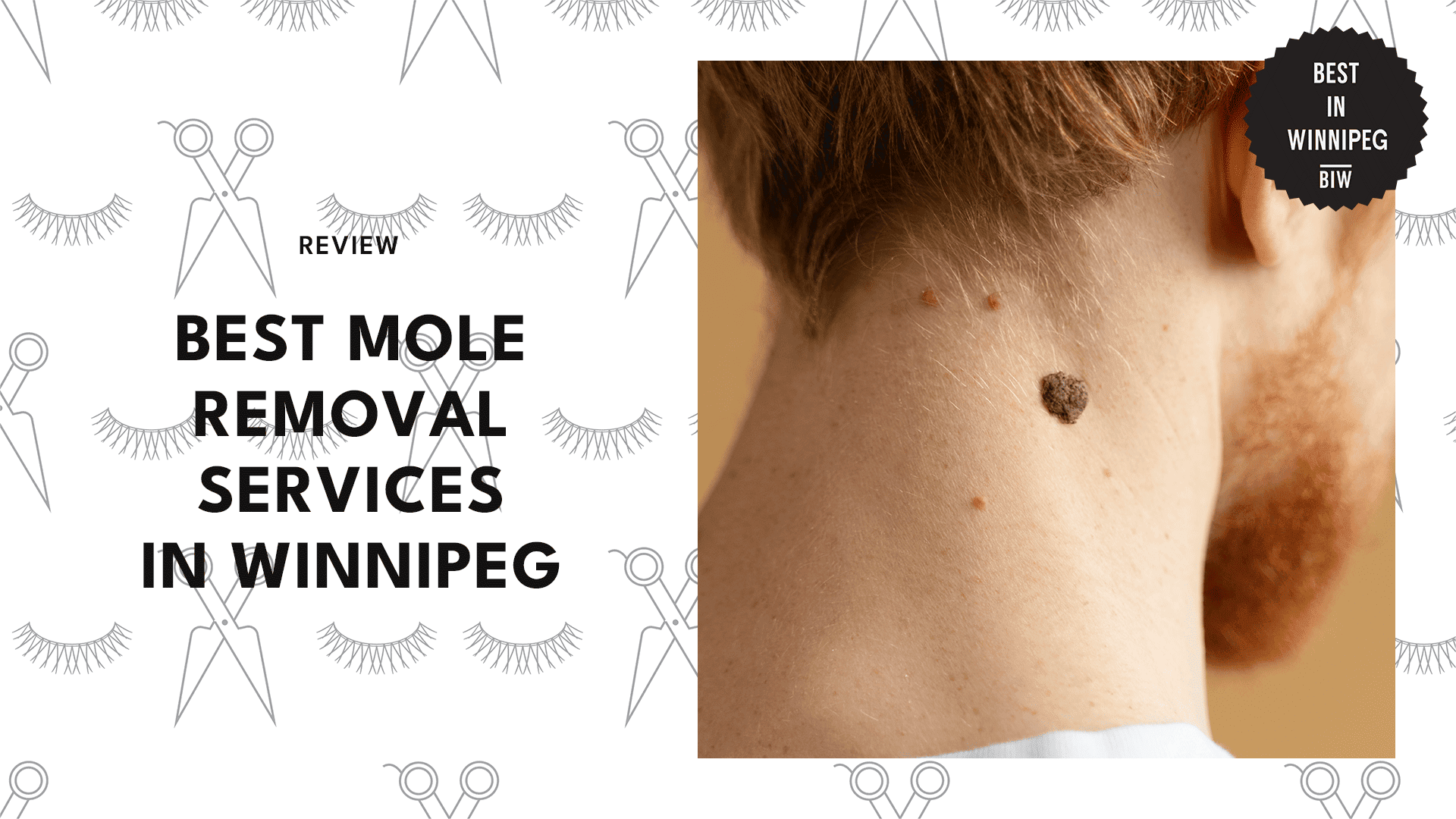 5 BEST MOLE REMOVAL SERVICES IN WINNIPEG