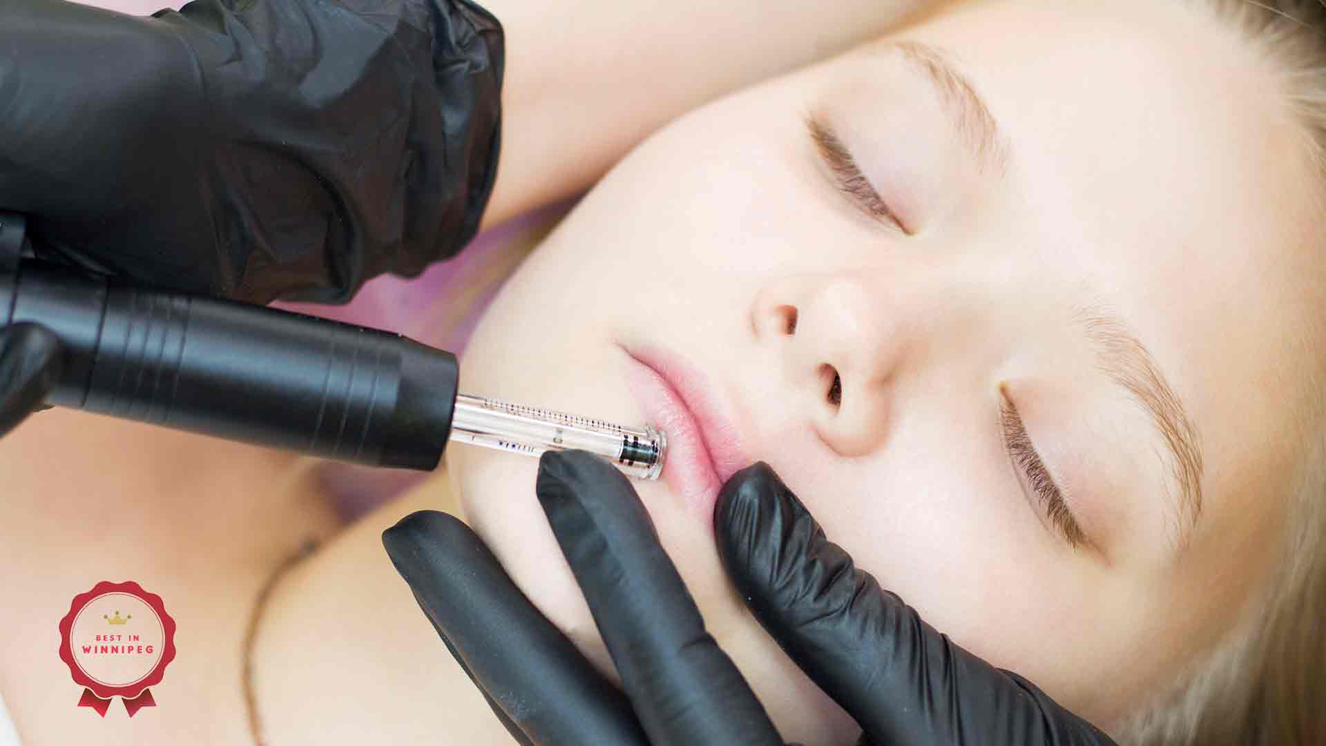 Best Clinics To Get Lip Fillers in Winnipeg