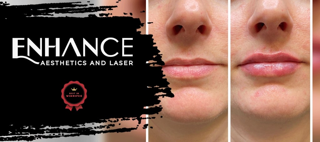 Enhance Medical Aesthetics