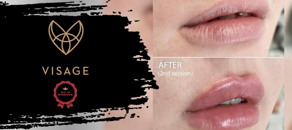 Visage - Plastic Surgery and Dermatology Clinic
