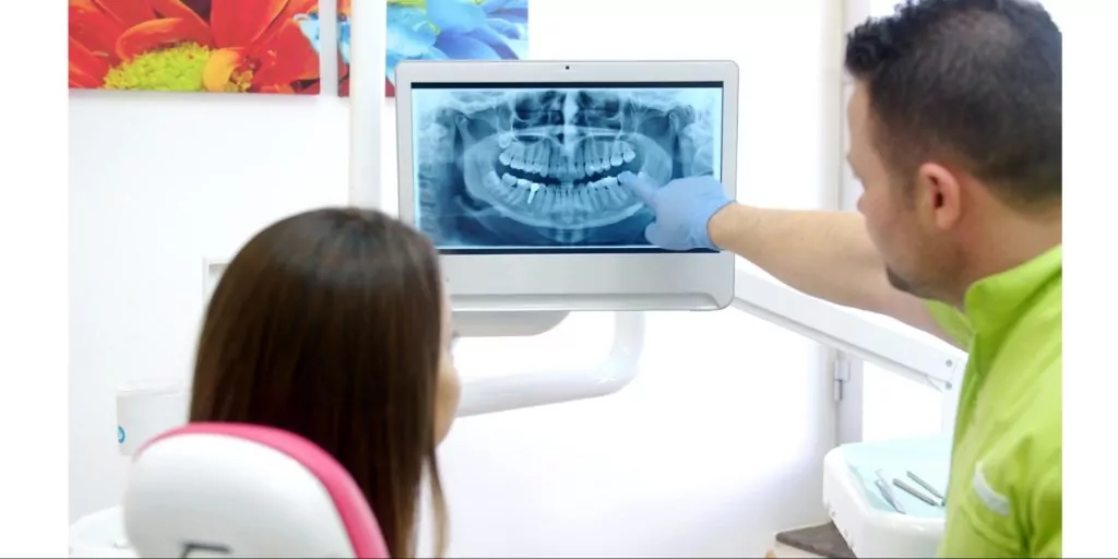 Purpose of Dental X-rays